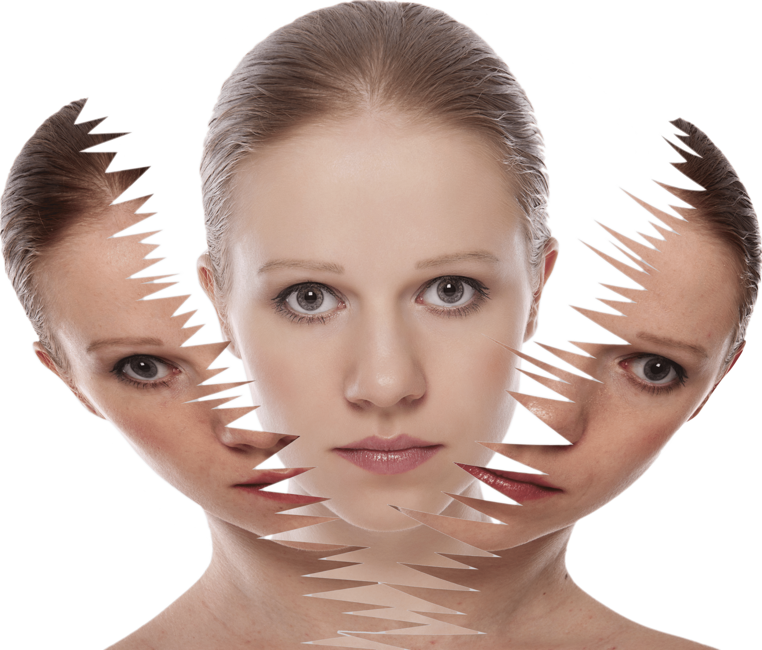 peling-quimico Tratamiento Melanostop mesopeel 3