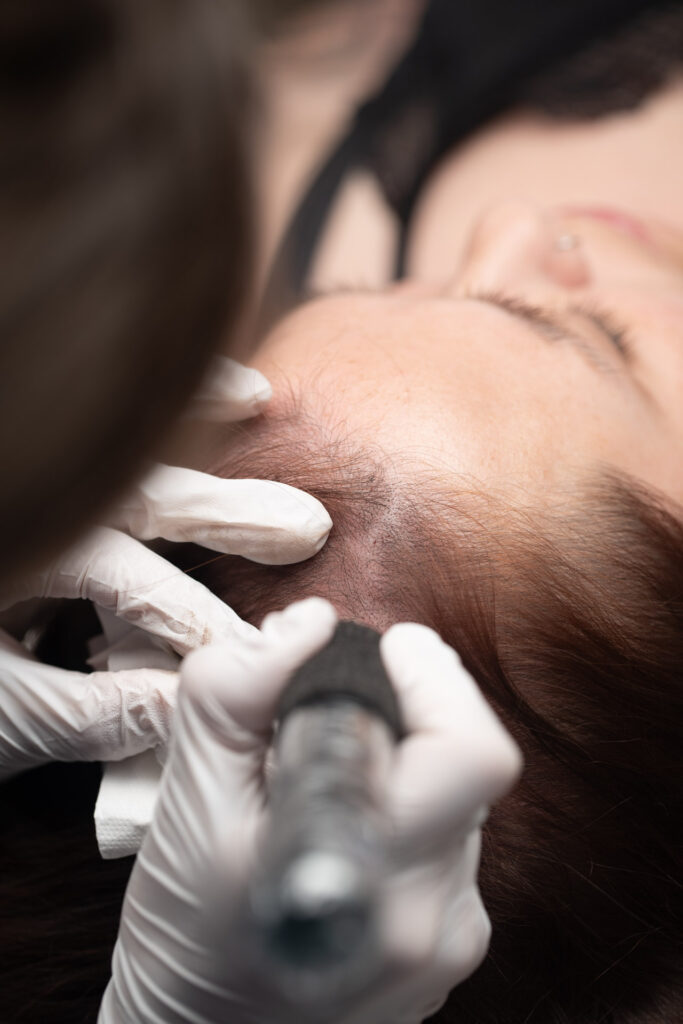 micropigmentacion capilar facial mujer proceso WEB 4