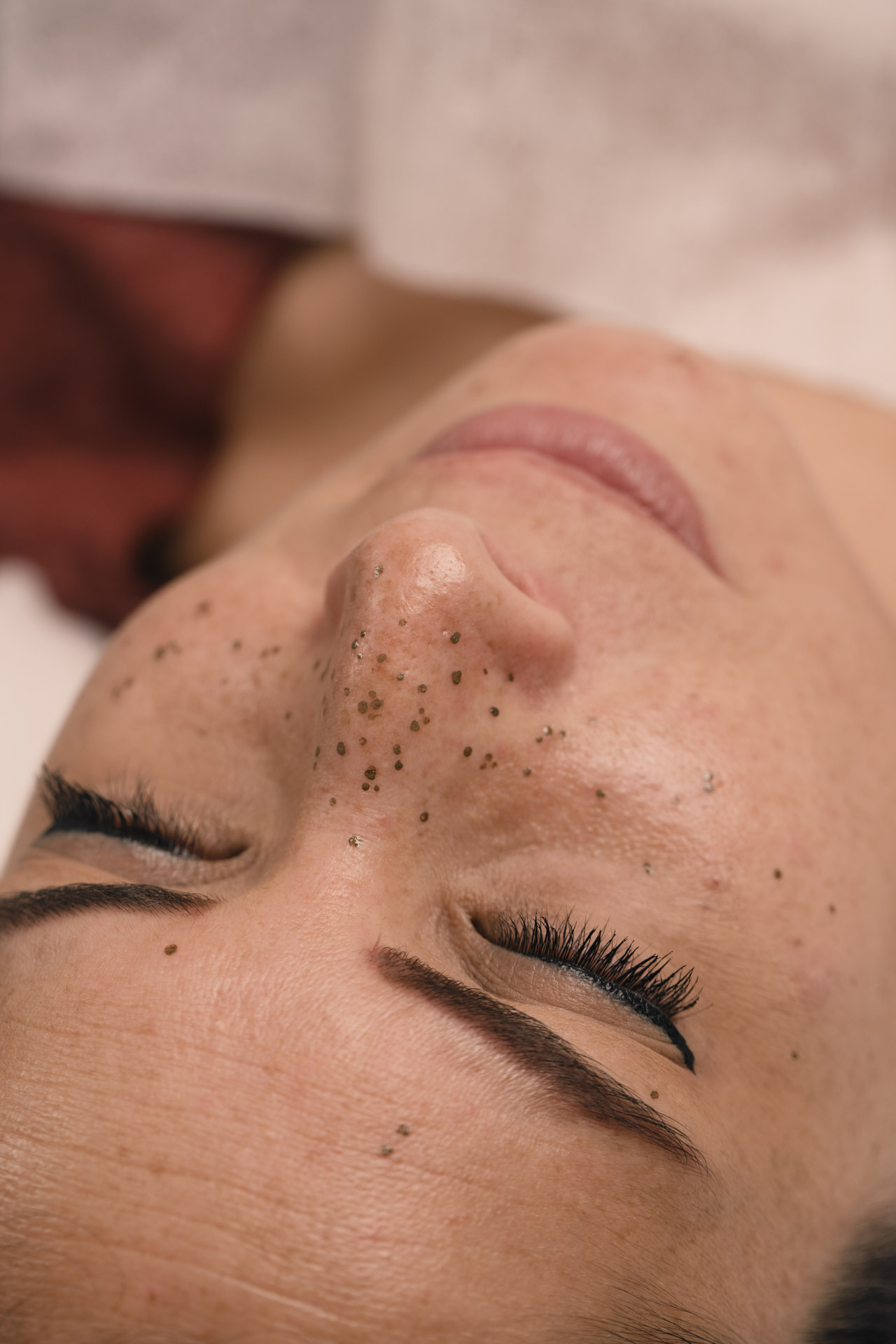 micropigmentacion pecas WEB 8