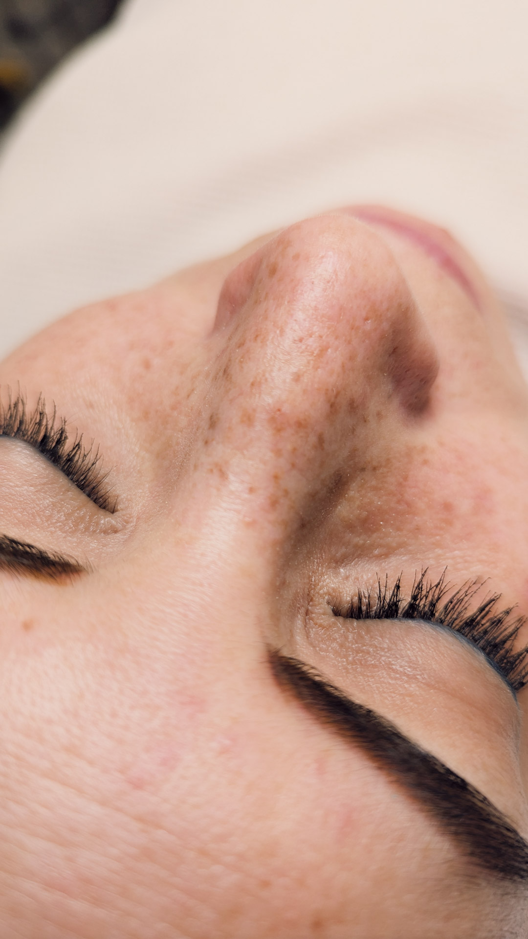 micro pecas cicatrizado carolina de la rosa web 6 micro pecas cicatrizado carolina de la rosa web 6