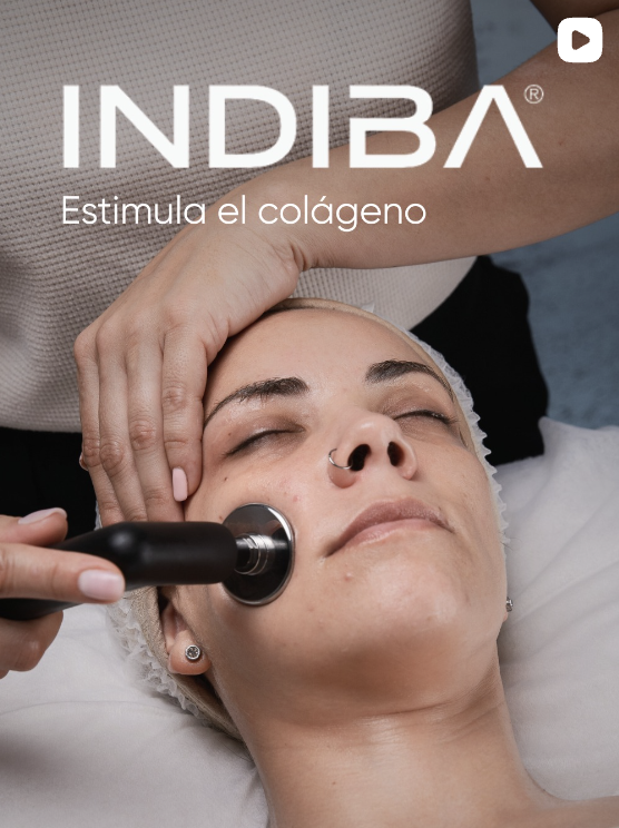 INDIBA Facial en Barcelona: rejuvenecimiento y lifting sin cirugía | Centros Carolina de la Rosa indiba facial barcelona