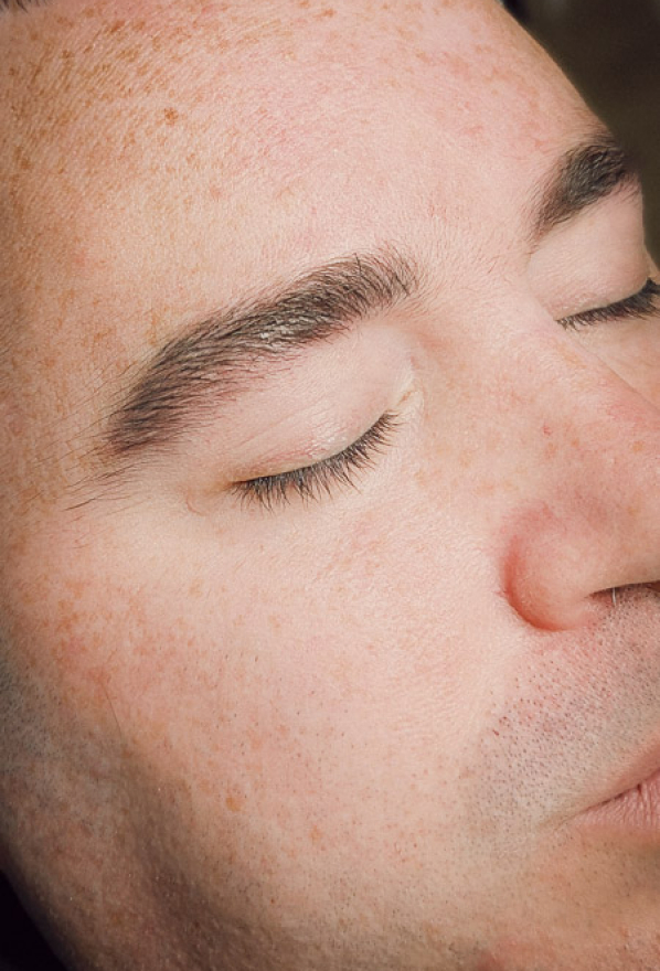 Micropigmentación de cejas en Barcelona | Centros Carolina de la Rosa Rostro